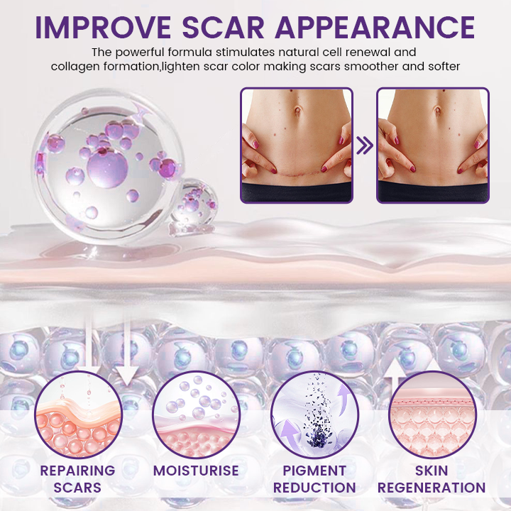 Timilk REGENSCAR Stem Cell Scar Gel provides a triple-action formula to help lock-in moisture - 20g