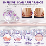 Timilk REGENSCAR Stem Cell Scar Gel provides a triple-action formula to help lock-in moisture - 20g